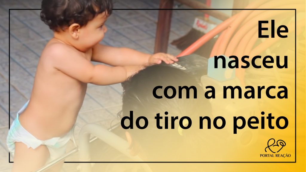 Criança Nasceu Com A Marca Do Tiro No Peito